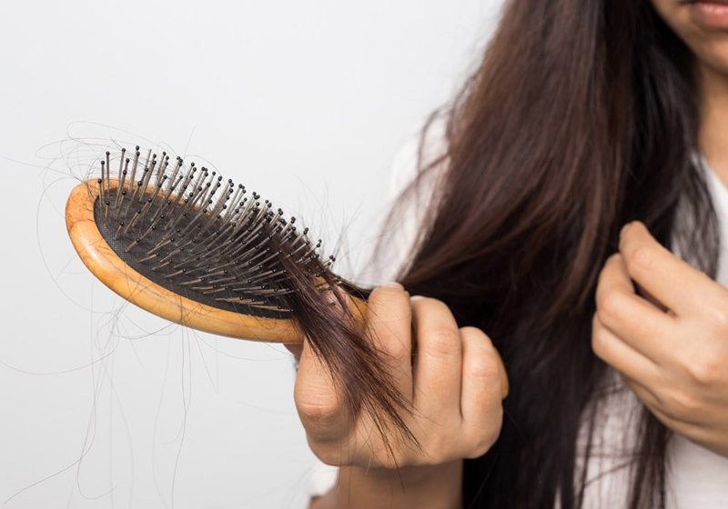 راه های جلوگیری از ریزش مو به صورت طبیعی